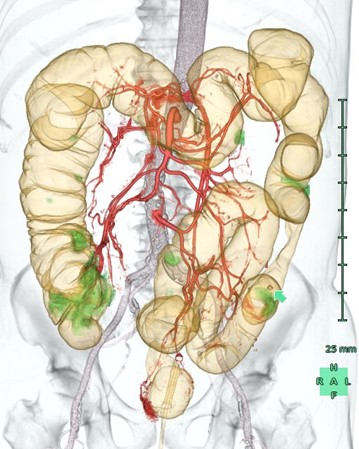 管腔臓器